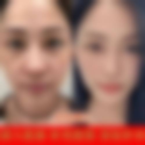 医院资质与实力:正规医美,具有影响力保护