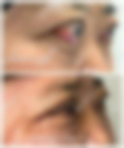 患者真实评价:做过手术的患者怎么说?