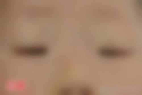 临床实例分享:找牟章兵医生治疗能达到好成效吗?