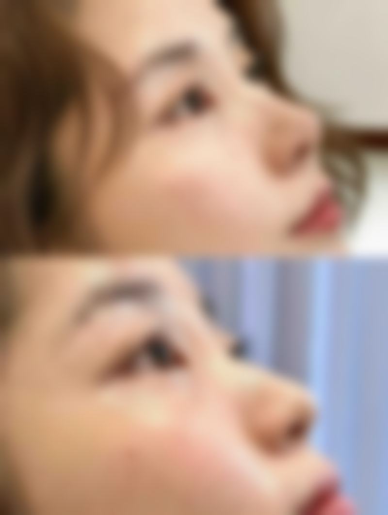 杭州颜术悦容医疗美容诊所怎么预约
