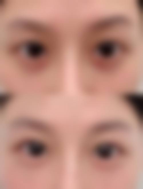 优惠活动详情——限时补贴别错过