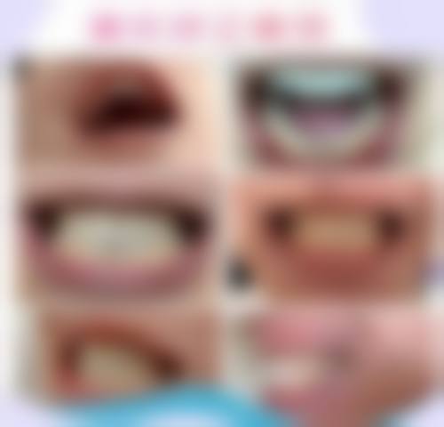 透明收费与优惠活动 – 看牙有优惠吗？