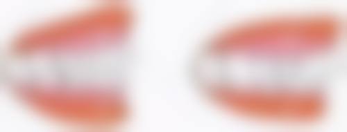 FAQ：解答常见疑问