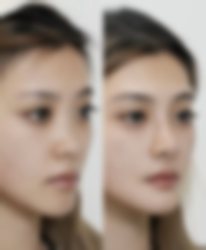 吉林星妍医疗美容门诊部收费价格表