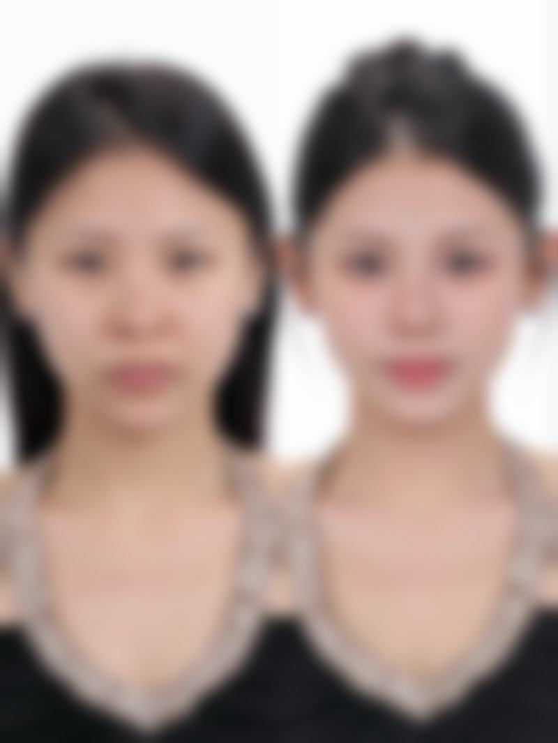 为什么不同资料给出的修复时间不一样呢？