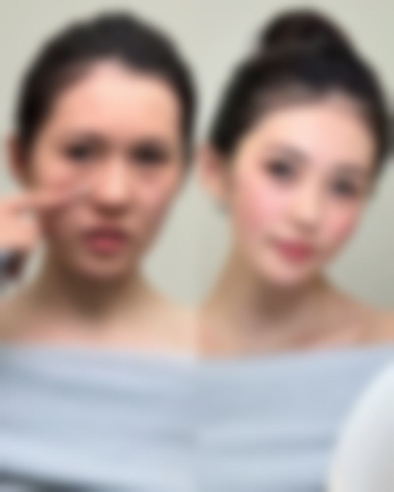 定期复查重要吗？