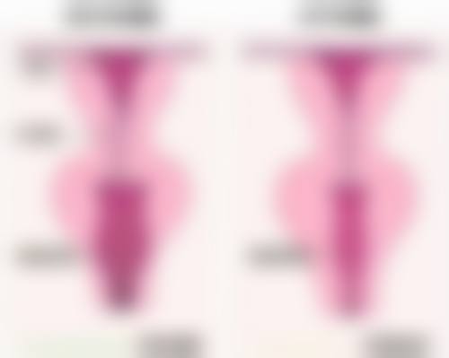 怎样预防疤痕的产生呢?