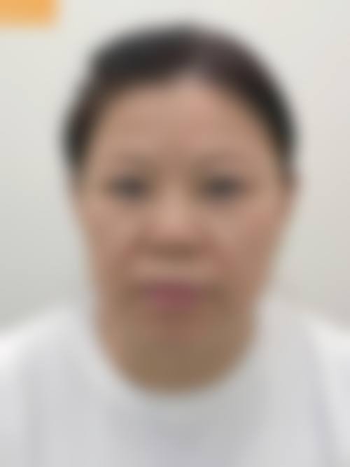 临床实例分享