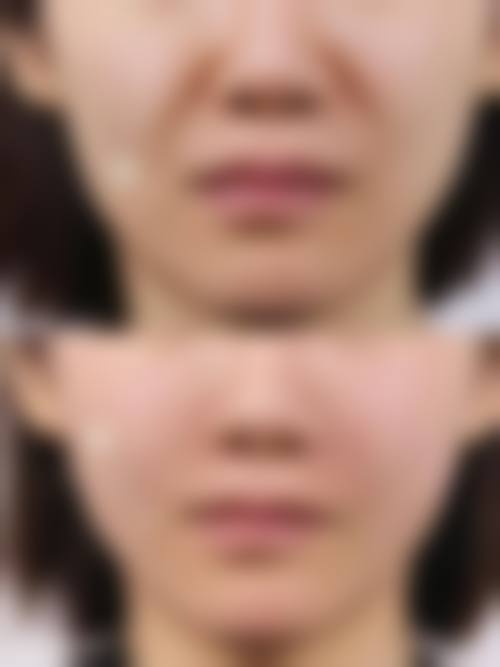 临床实例分享:宗志彬医生北京奈澈医疗美容医院