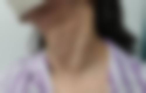 患者真实评价