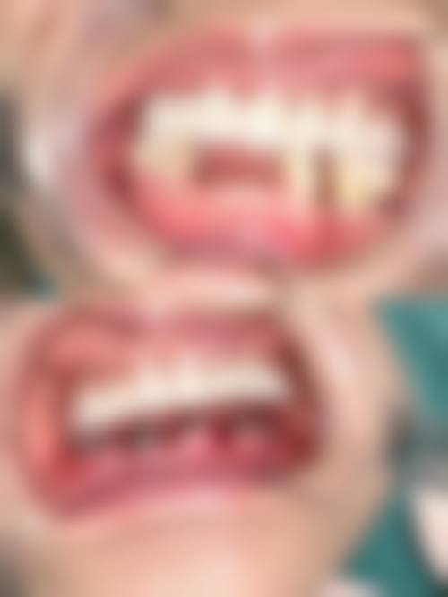 常见问题解答