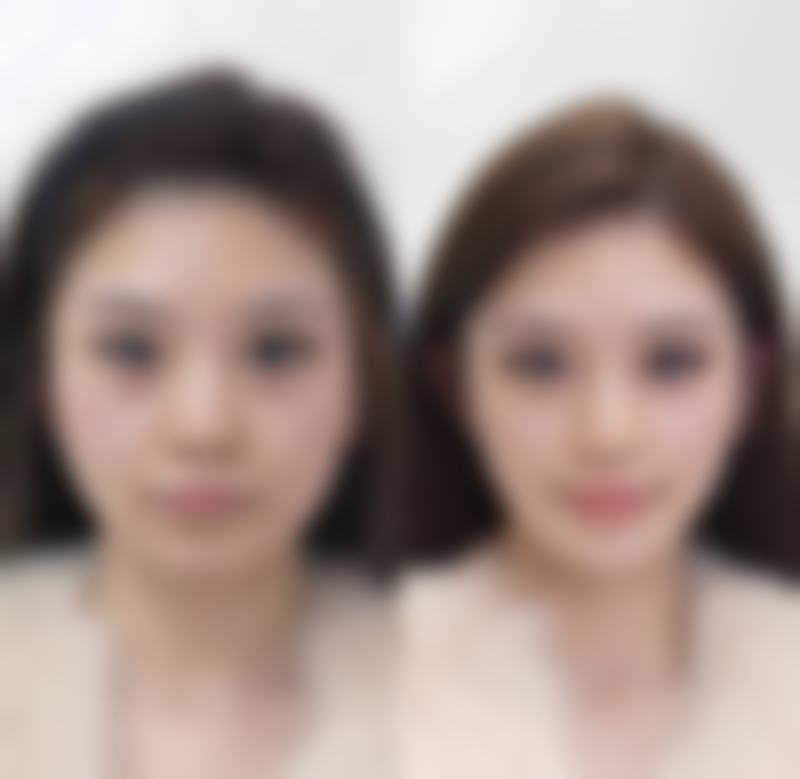郴州臻颜美医疗美容诊所正规吗?