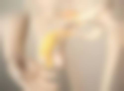 白山汉诚整形医院好医生割双眼皮技术怎么样?