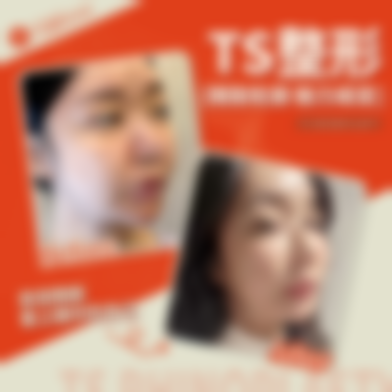 2026全新价格明细——韩国TS整形医院李相均联系方式的性价比解析