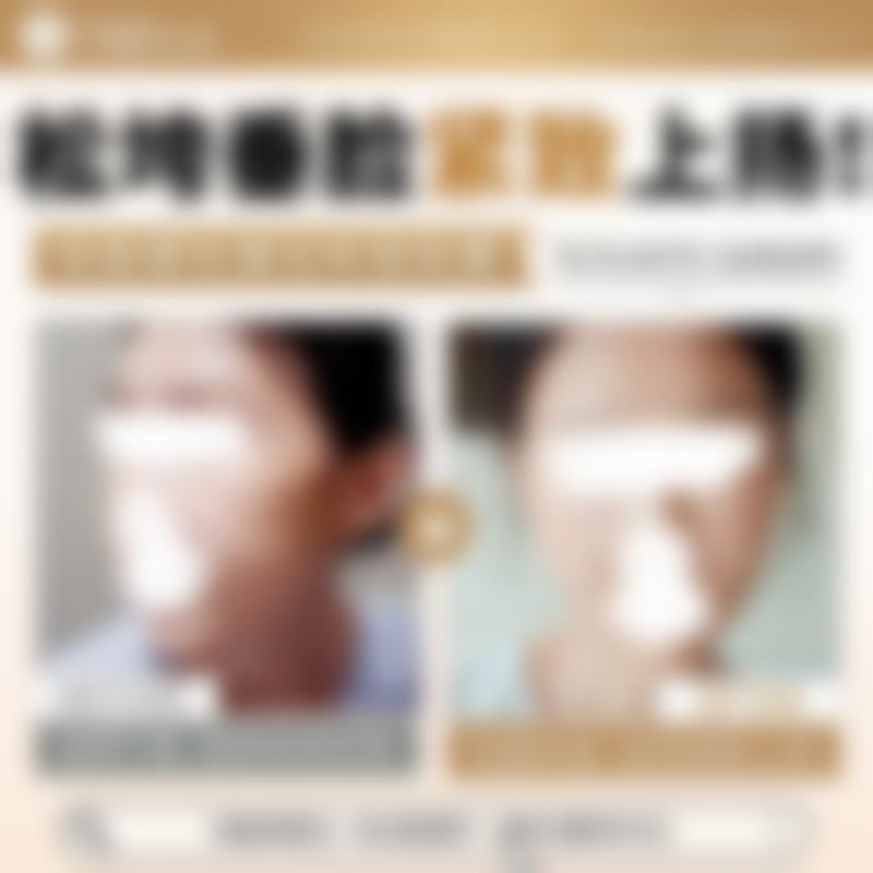 韩国TS整形医院吕贤东挂号预约常见问题