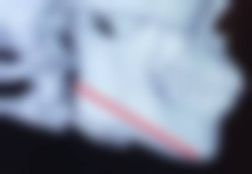 拉萨熙熳整形医院怎么预约