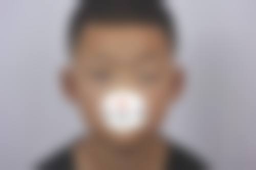 临床实例分享