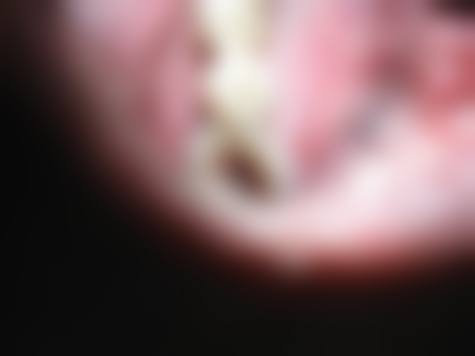 擅长项目详解