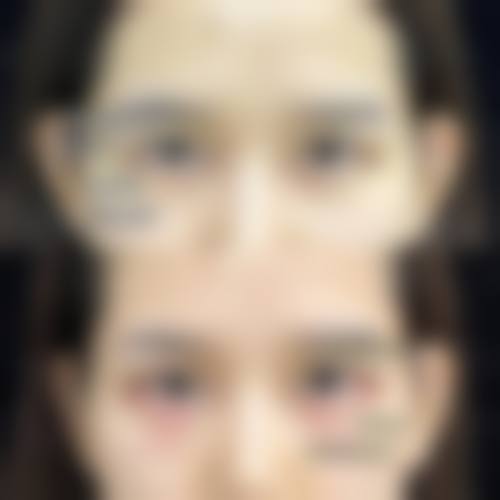 擅长项目详解