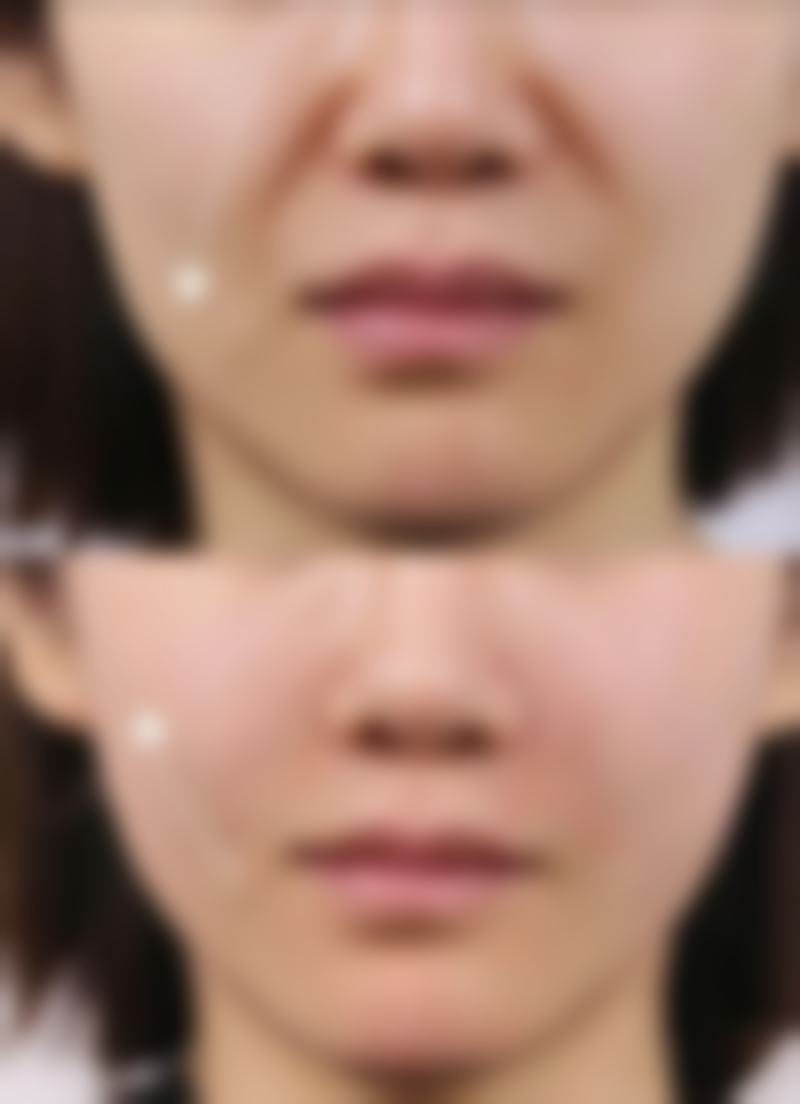 韩国Nature整形外科黄正勋医生擅长项目