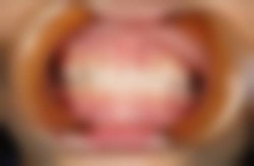 FAQ:常见问题解答