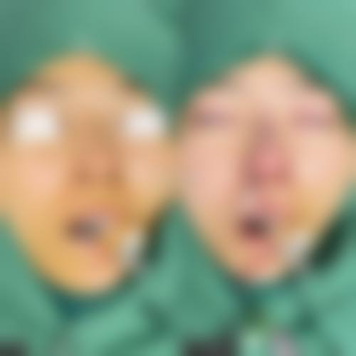 临床实例分享