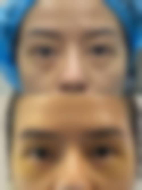 优惠活动详情