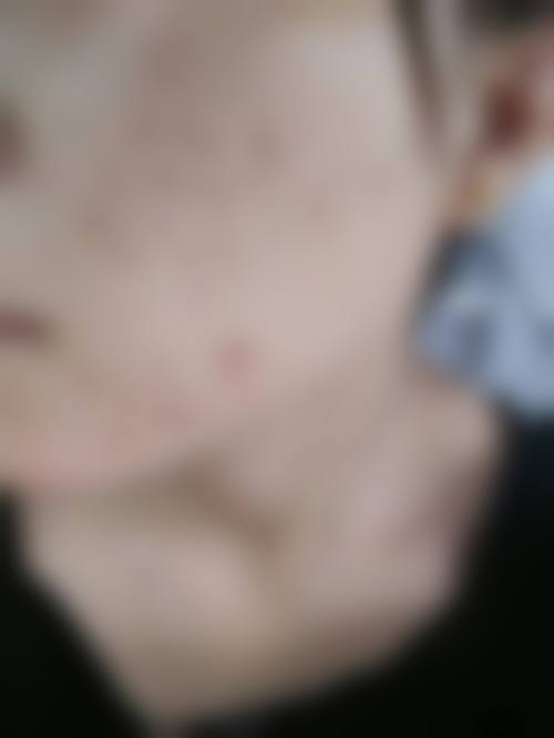 预约优惠活动