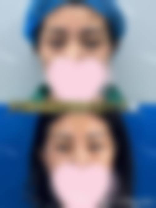 擅长项目详解：楼晓莉医生擅长做我需要的项目吗？