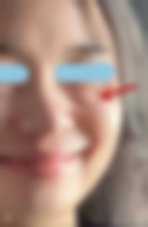医生资质介绍：楼晓莉医生靠谱吗？