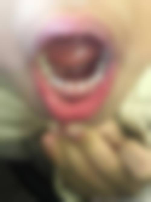 临床实例分享