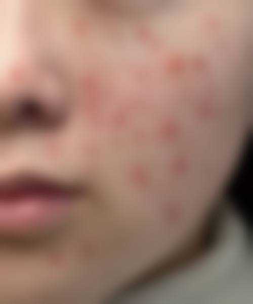 设备环境介绍:科技助力精细治疗