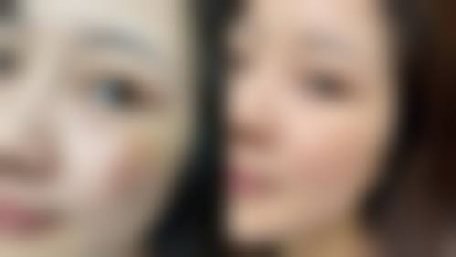 服务流程与患者保护:从询问到术后全程贴心