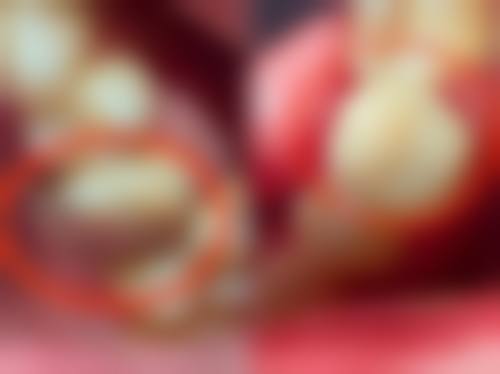 优惠活动详情:用更实惠的价格获得好牙