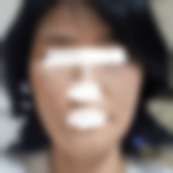常见疑问解答