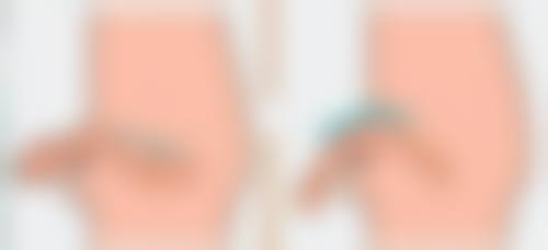 服务流程与医生团队:专精保护与个性化关怀