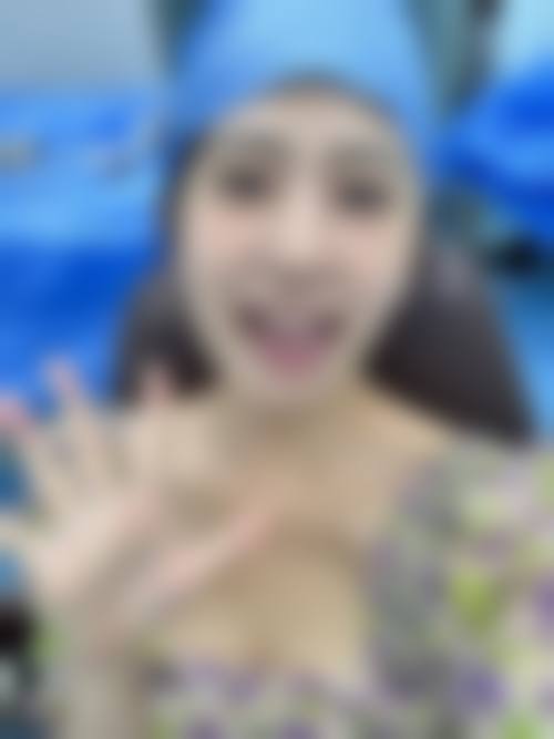 临床实例分享-平顶山佳美口腔门诊部王文飞