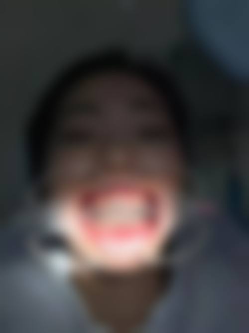 临床实例分享