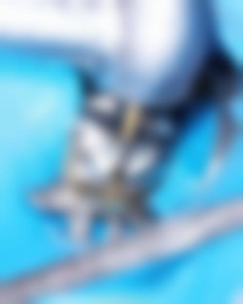 临床实例分享