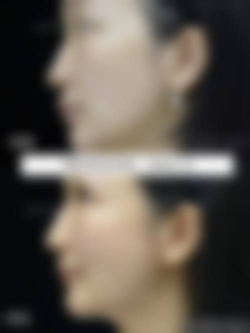 补贴活动与预约引导:立即到院享专属优惠