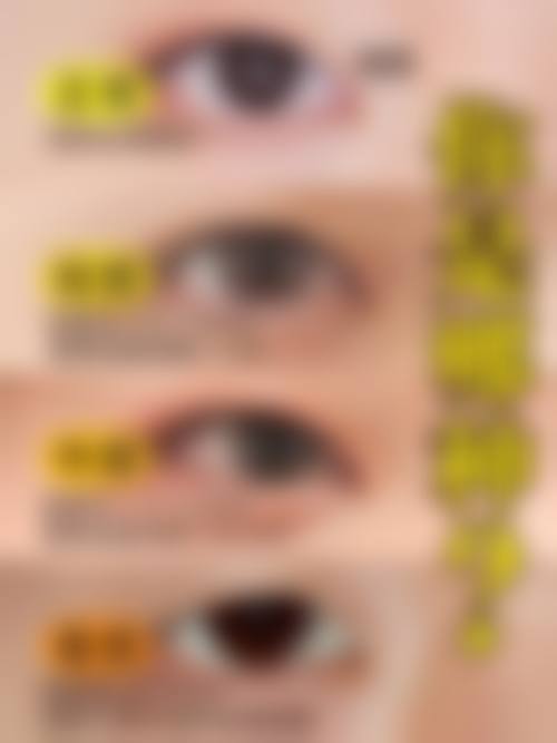 预约优惠活动 张家口市第四 医院眼科卢轶