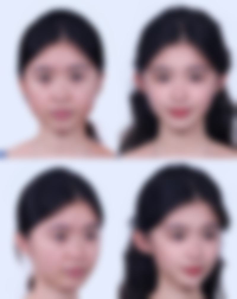 预约优惠活动 朱乾丽 上海盛美倾城医疗美容门诊部