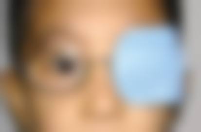 临床实例分享