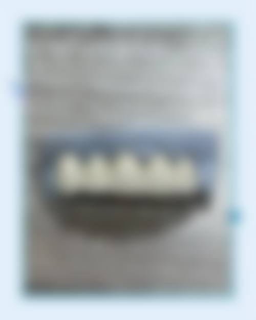 特色服务项目与技术：从洁牙到种牙的全方面口腔呵护