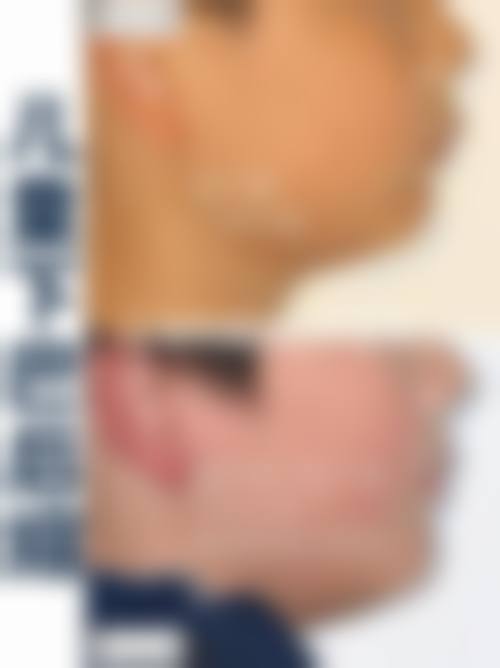 优惠活动详情，高性价比之选