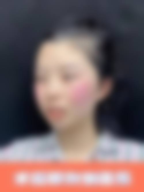 优惠活动详情：限时补贴不容错过