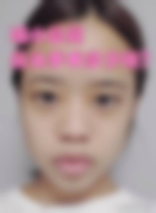 特色科室与项目:韩式定制,精细化塑美