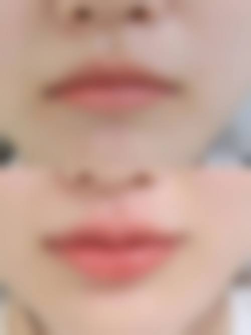 总结:实力与优惠兼备的医美选择