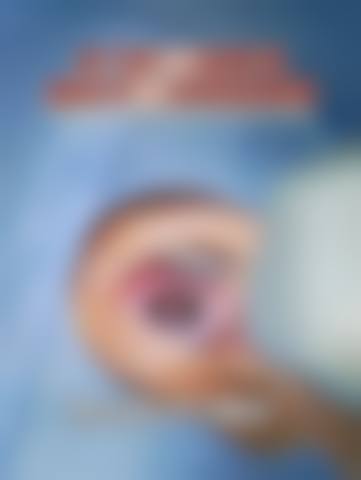 临床实例分享