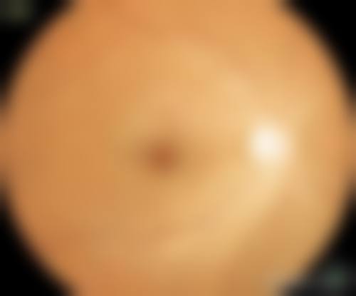 临床实例分享